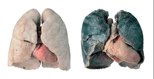 healthy and smokers lungs