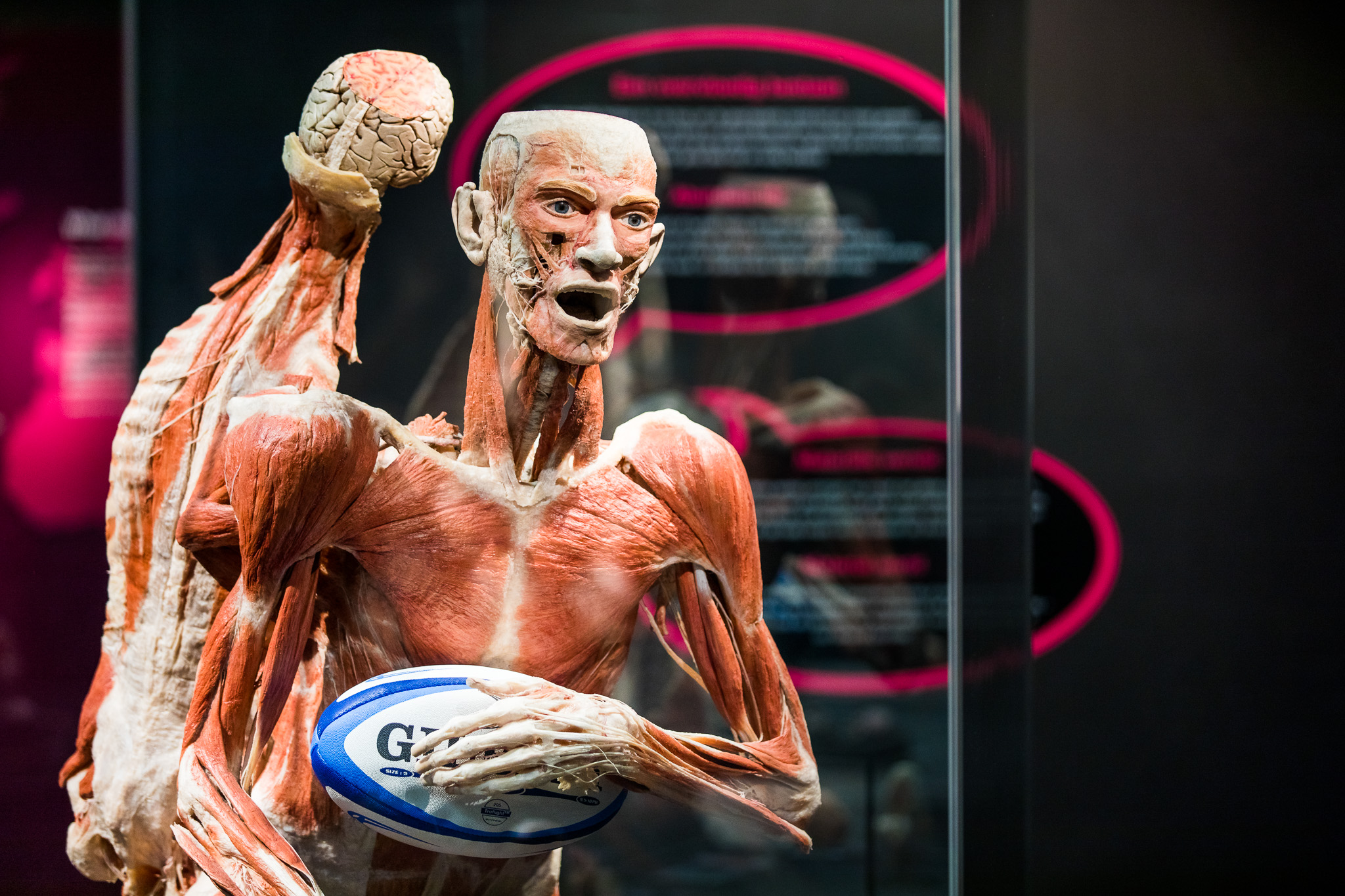 20180807 Body Worlds 066 44161