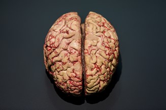 brain brein hersenen hersenpan